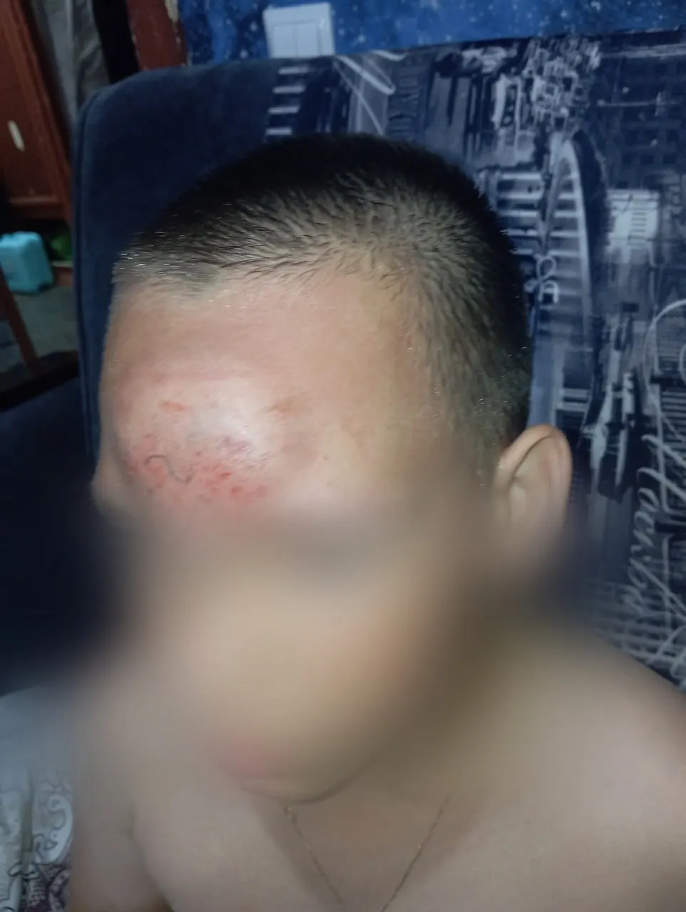 По словам местных жителей, ребёнок получил серьёзные переломы и был доставлен в отделение нейрохирургии; следственные органы проводят проверку.